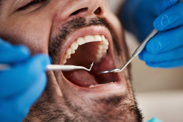 Dentist for Dental Trauma in NM