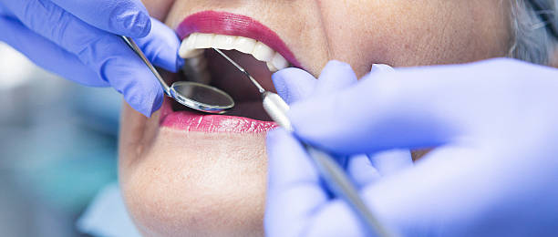 Best Chipped Tooth Repair Near Me  in Valencia, NM